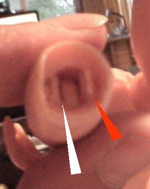 Close-up of an ear with a red and white arrow pointing inside.