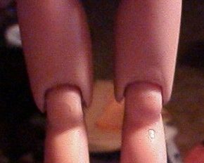 Close-up of a hand with fingers bent unusually.